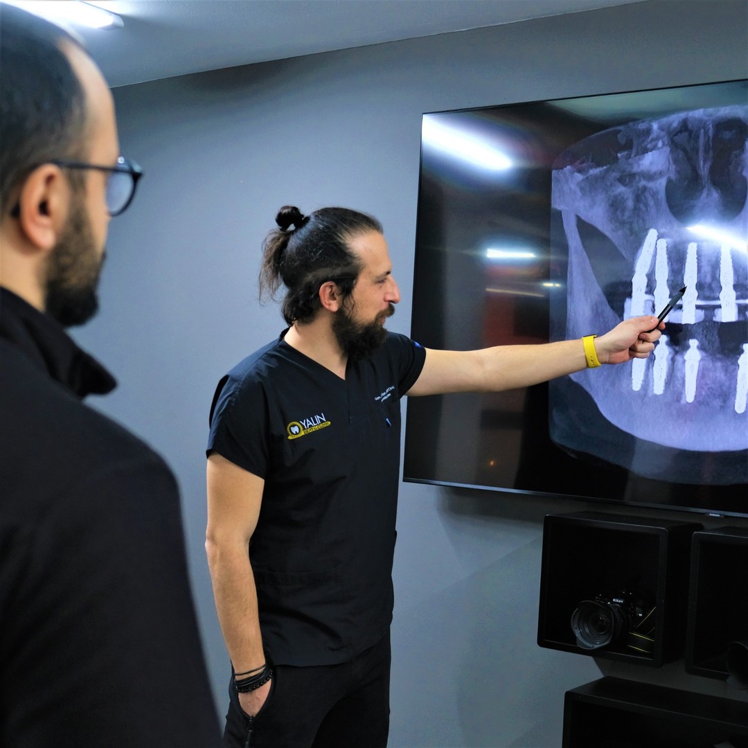 Dentist explaining a 3D implant scan to a patient at Yalın Dental Clinic, Antalya