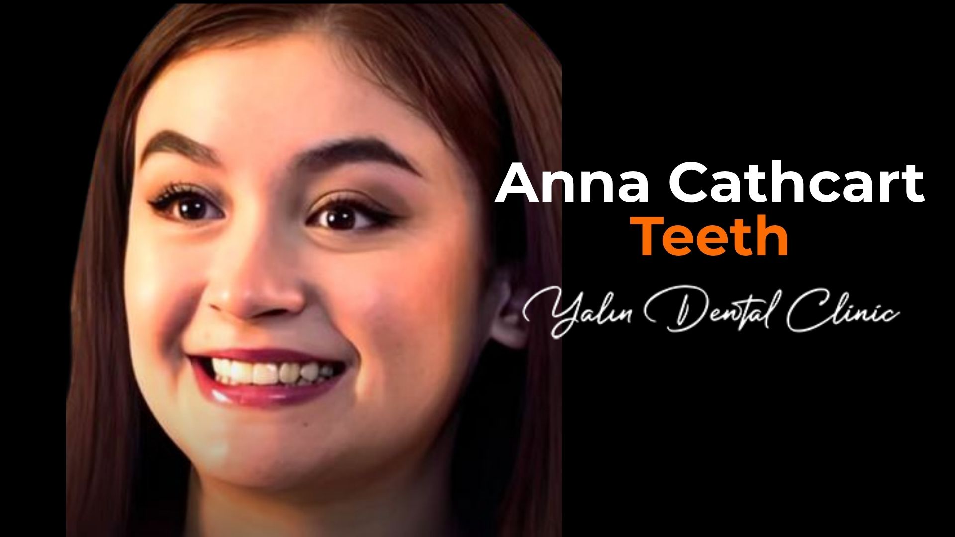 anna-cathcart-teeth anna-cathcart-teeth