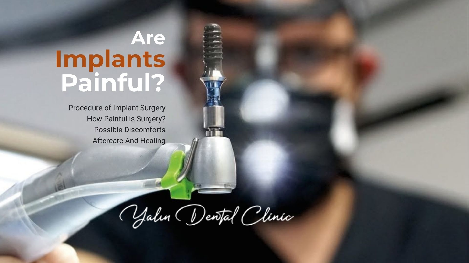 Are Dental Implants Painful? Are Dental Implants Painful?