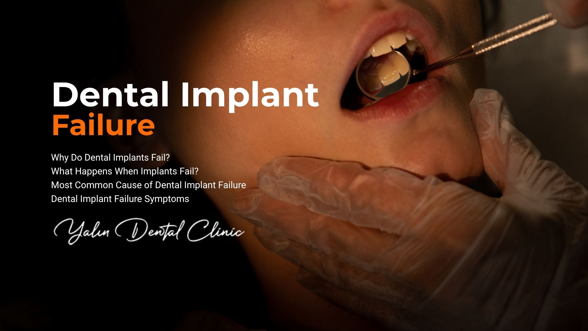 dental-implant-failure