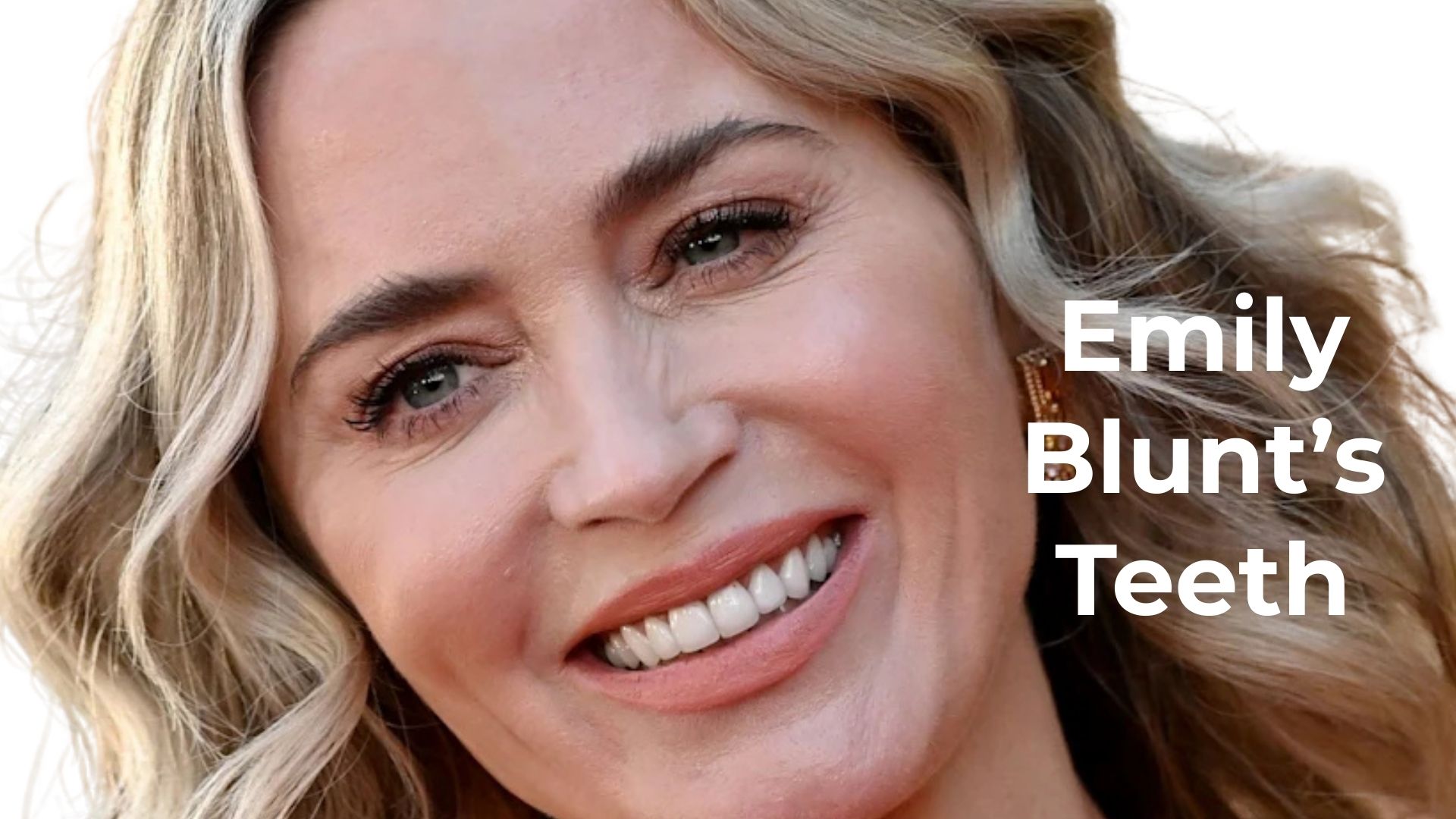 Emily Blunt’s Teeth