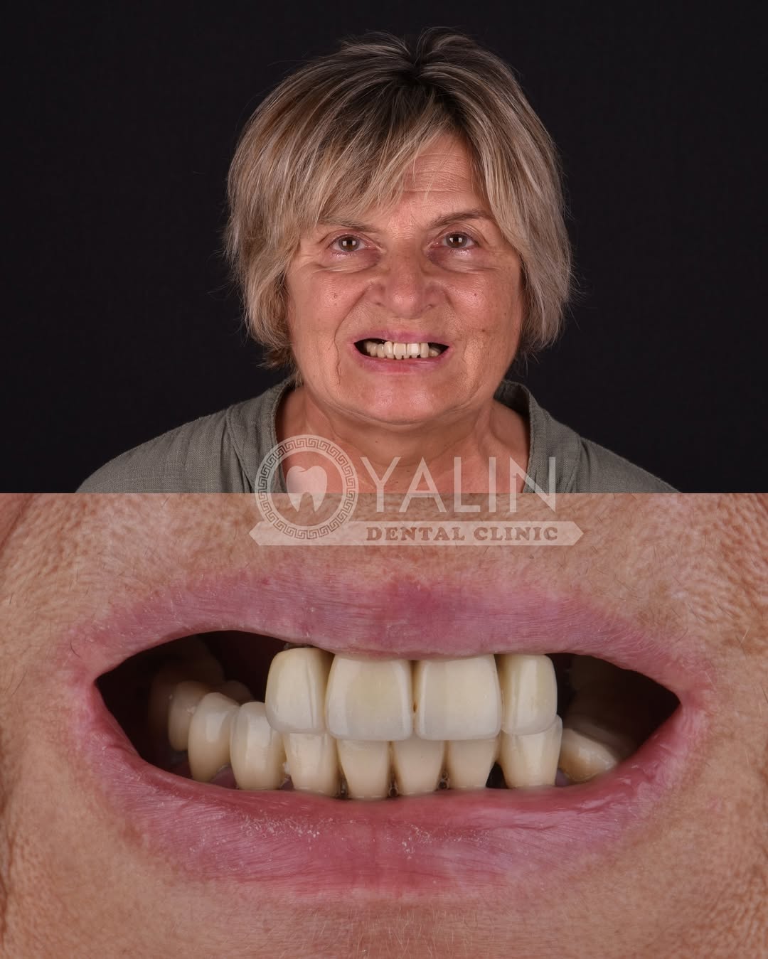 dental treatments before and after-1