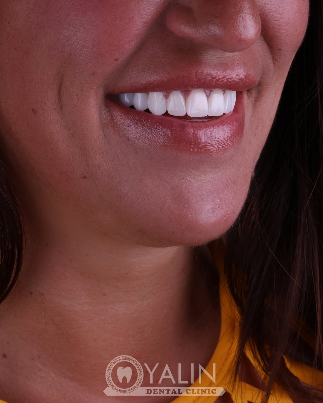 dental treatments before and after-10