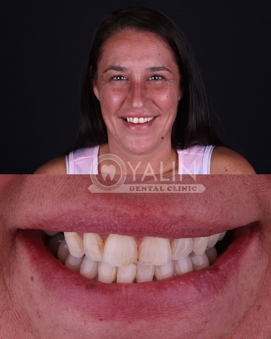 dental treatments before and after-12