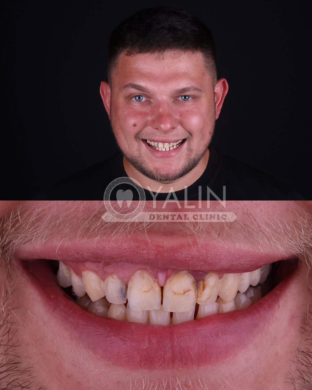 dental treatments before and after-15