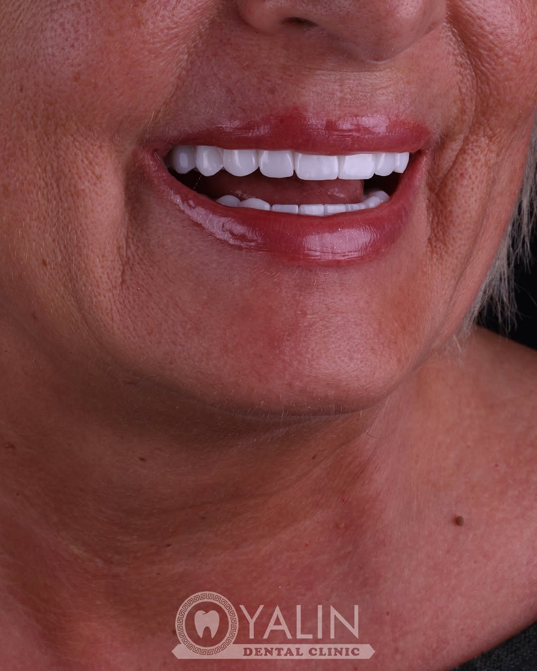 dental treatments before and after-2