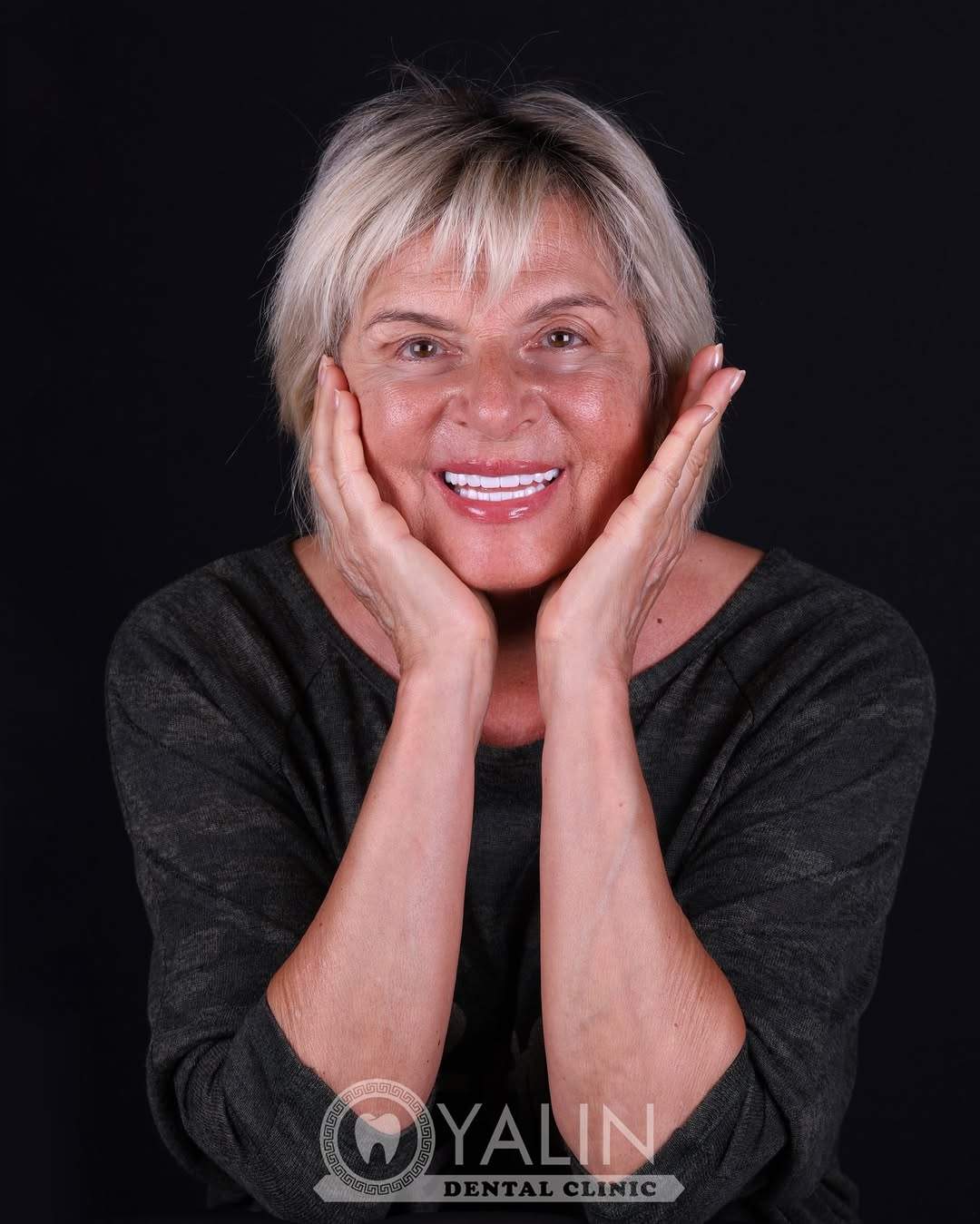 dental treatments before and after-3