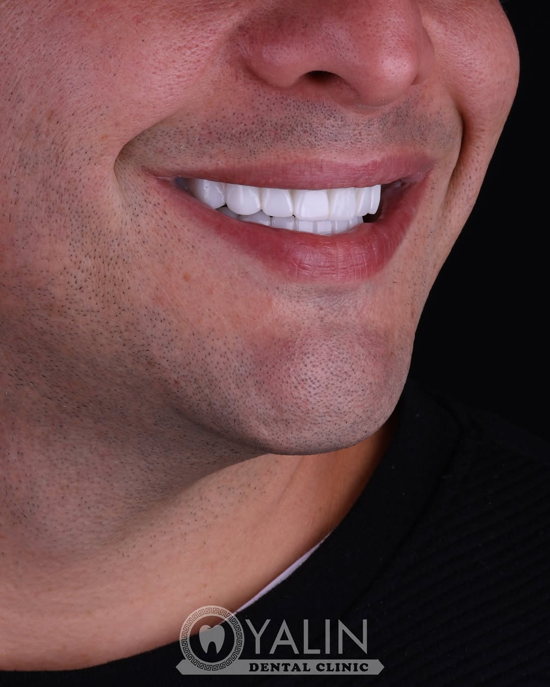 dental treatments before and after-5