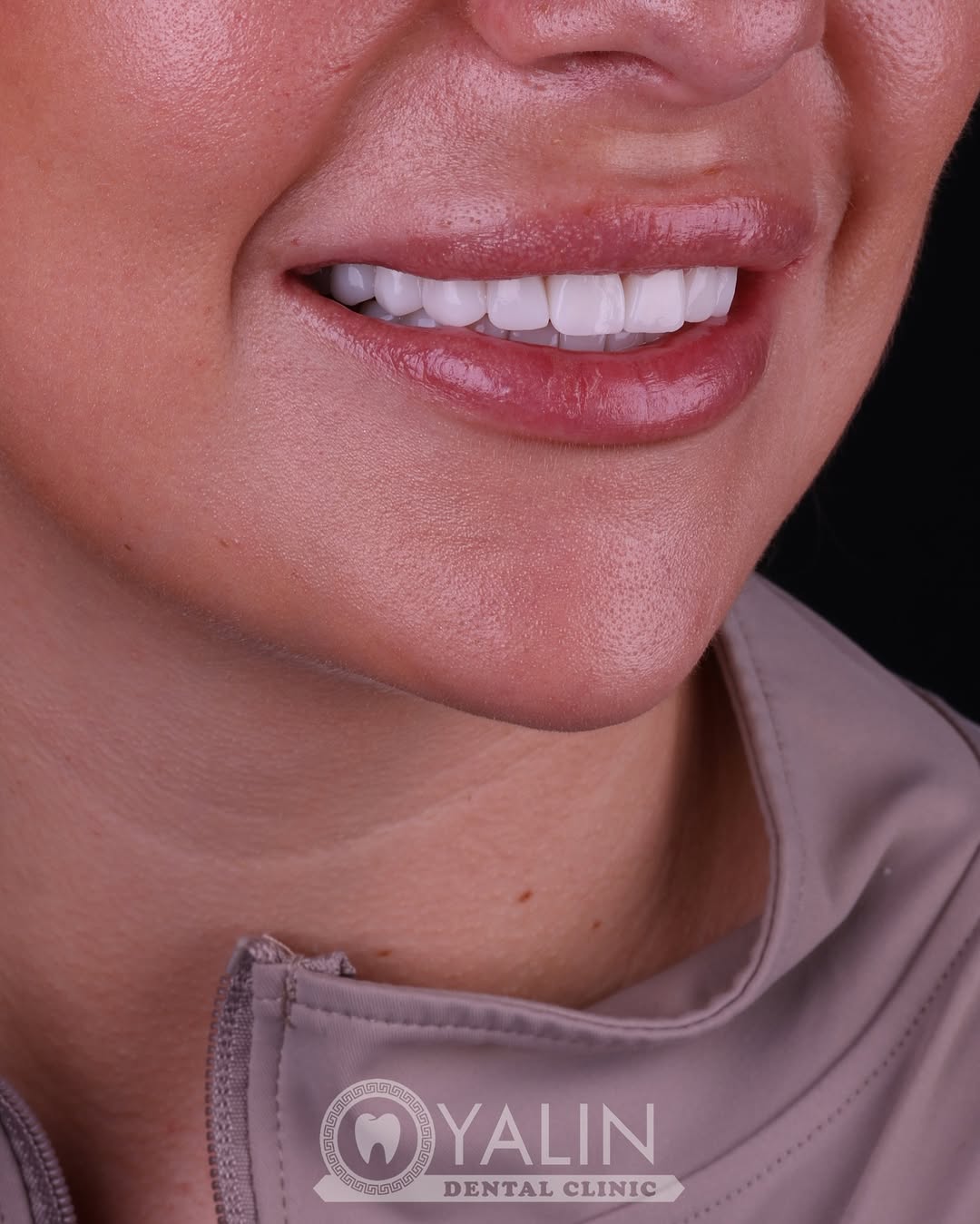 dental treatments before and after-7