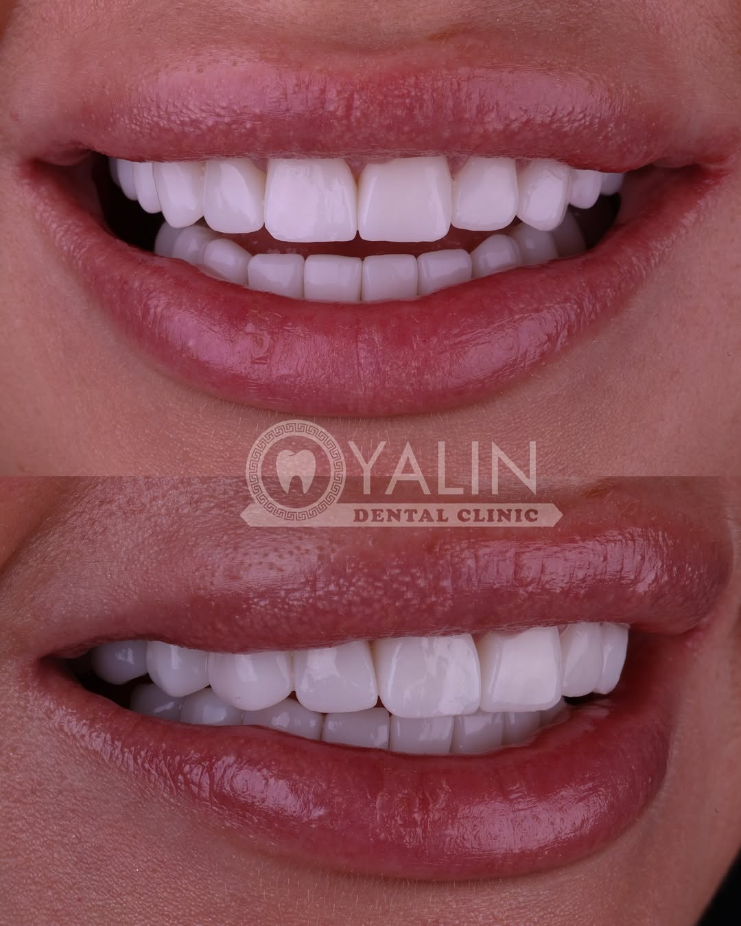 dental treatments before and after-8