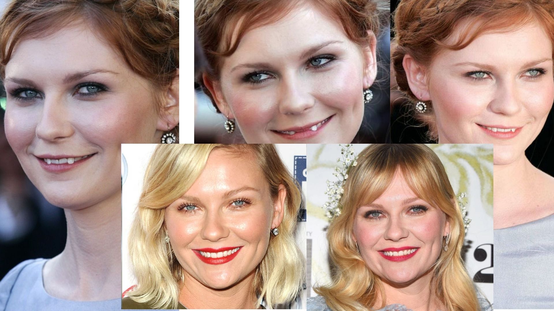 Kirsten Dunst teeth before and after Kirsten Dunst teeth before and after