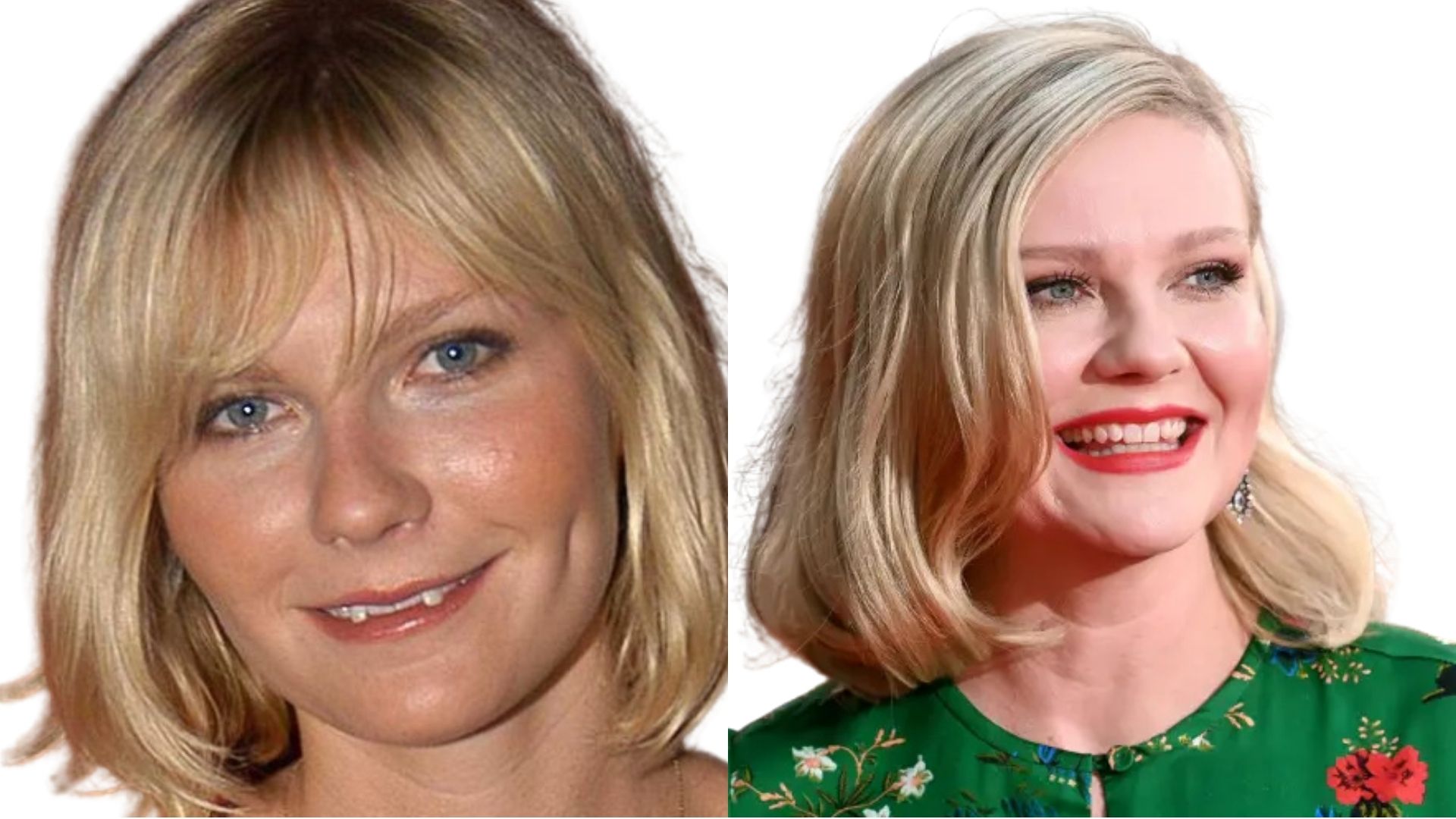 Kirsten Dunst teeth before and after Kirsten Dunst teeth before and after