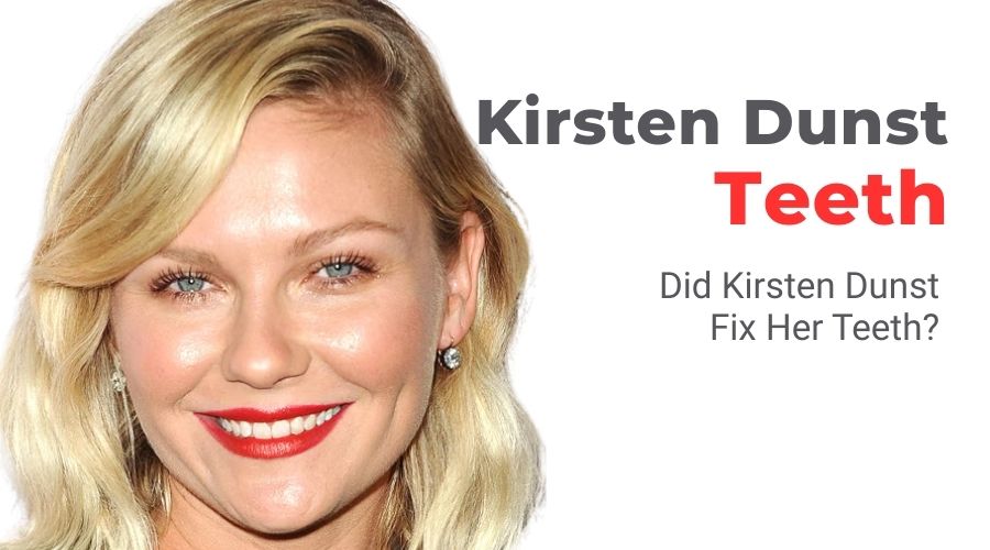 kirsten-dunst-teeth kirsten-dunst-teeth