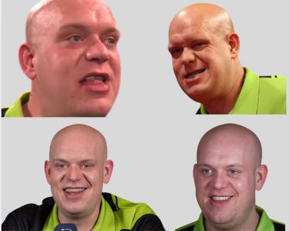Michael Van Gerwen teeth before and after