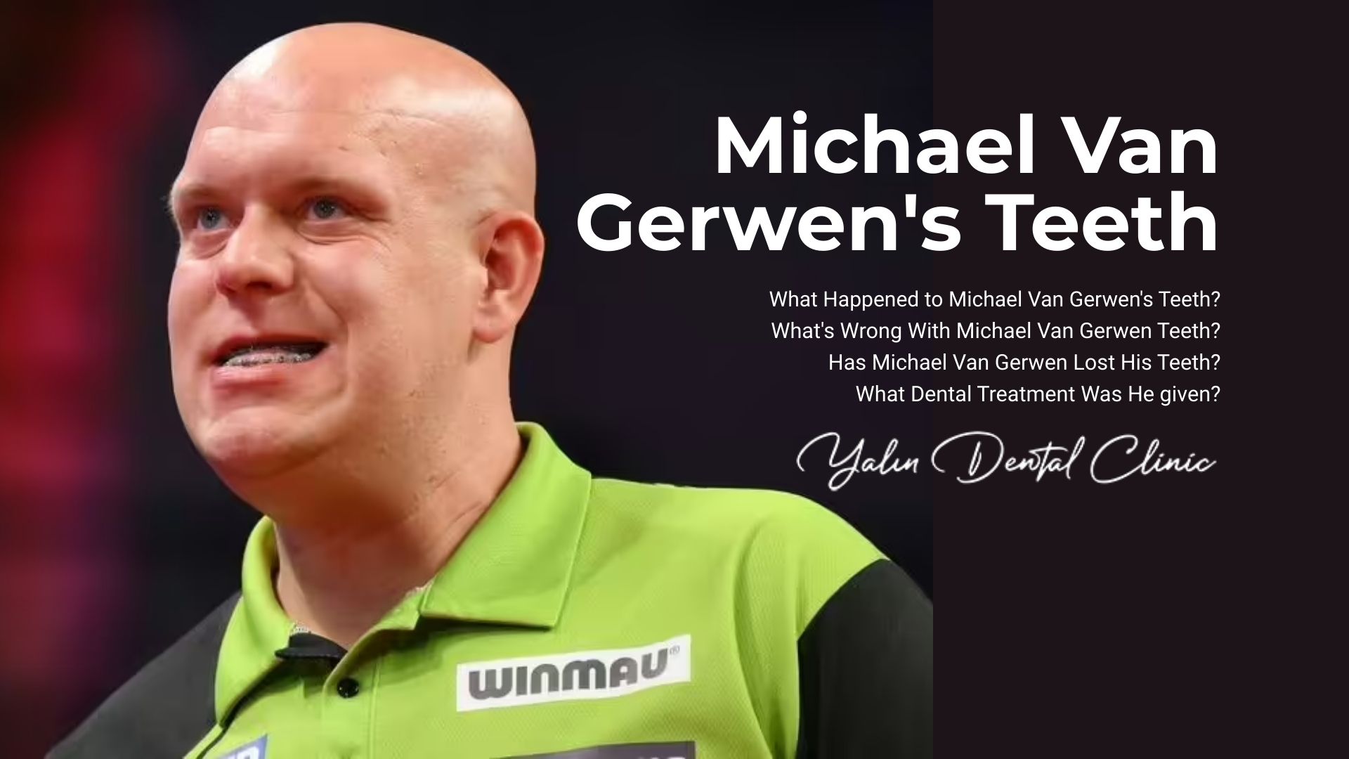 What happened to Michael Van Gerwen's teeth? What happened to Michael Van Gerwen's teeth?