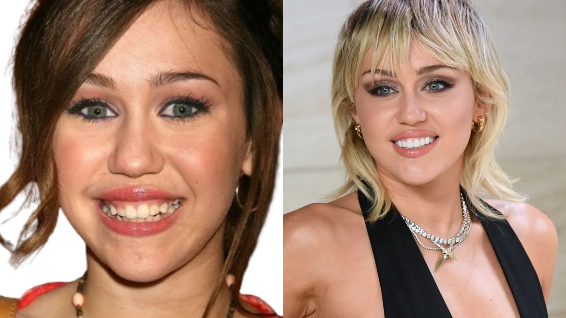 Miley Cyrus smile makeover