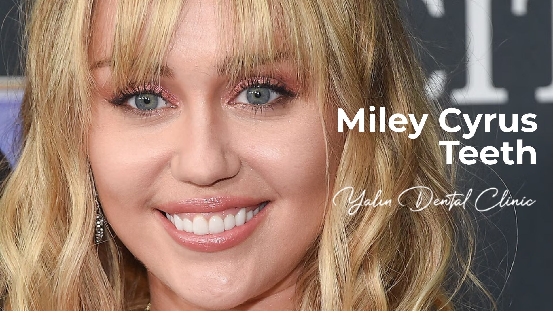 miley-cyrus-teeth