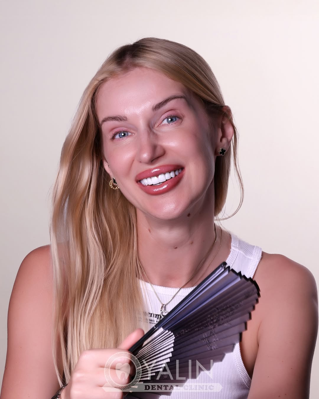 Yalındental Clinic, smile-makeover-1