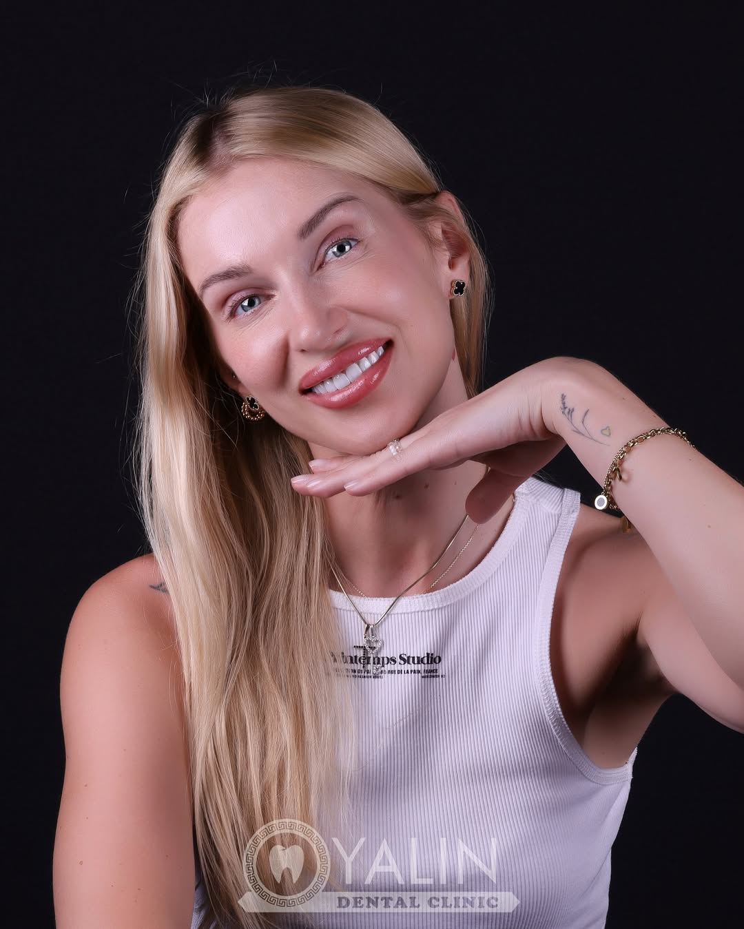 Yalındental Clinic, smile-makeover-1