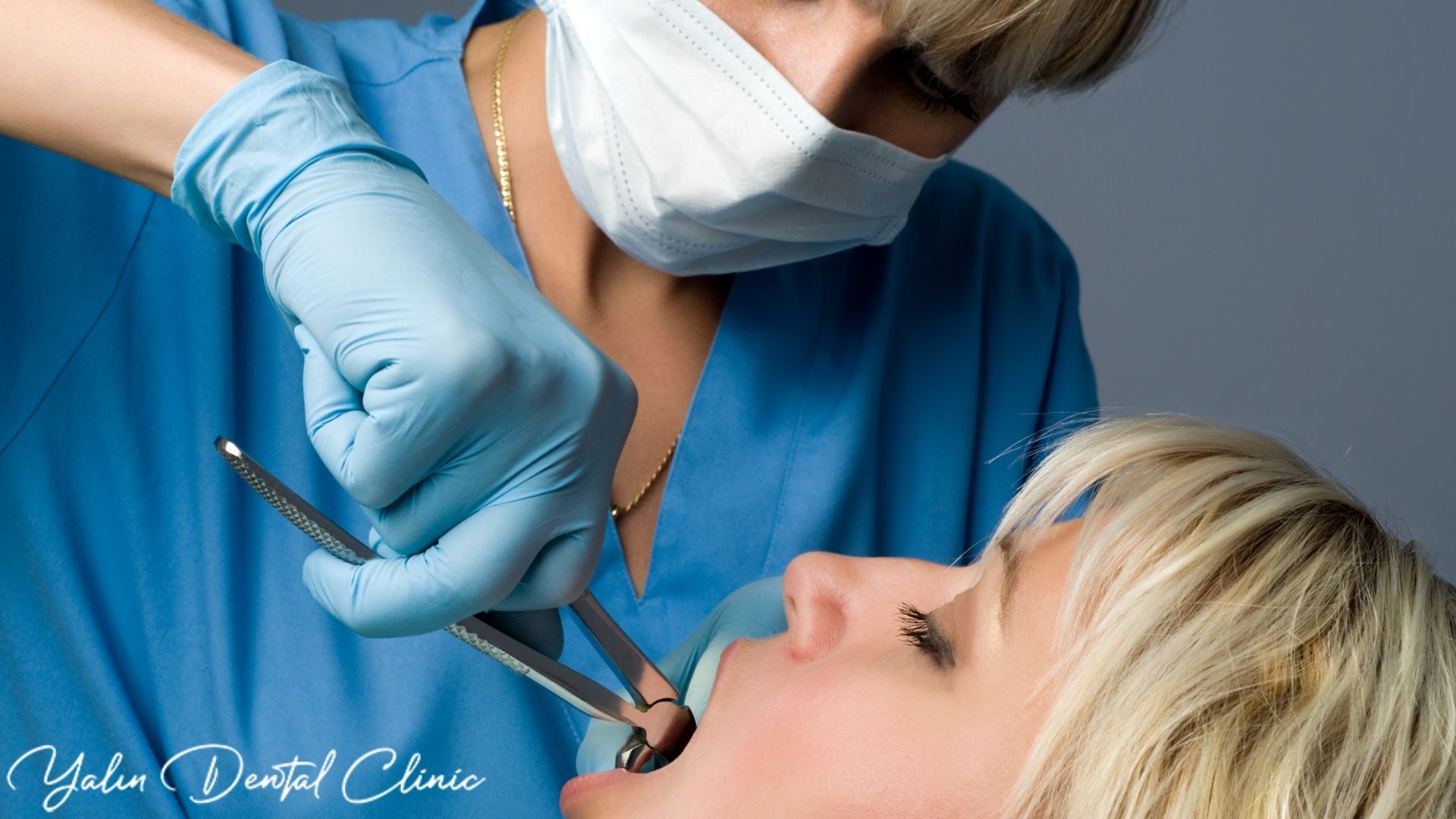 tooth extraction, wisdom tooth removal