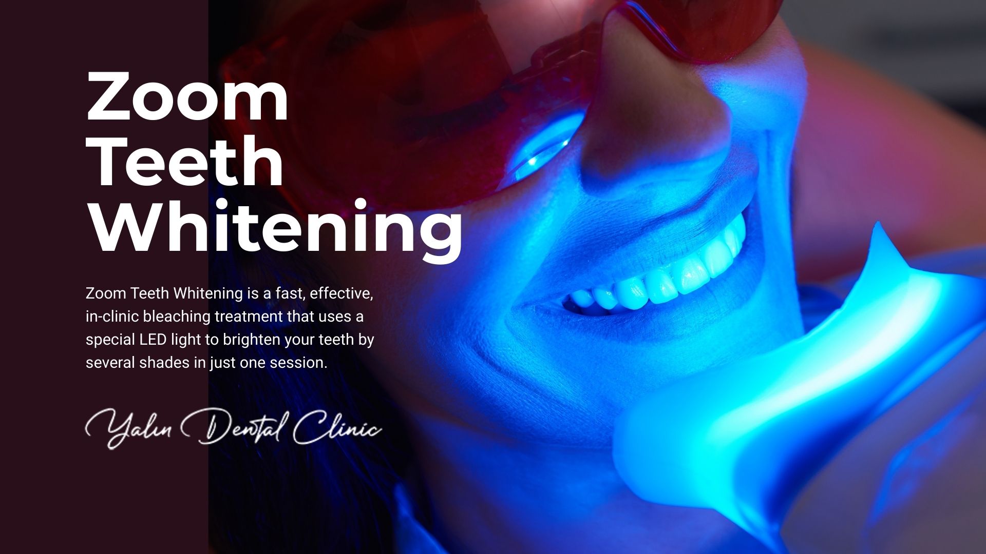 Zoom Teeth Whitening